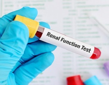 Kidney Profile / Renal Profile 